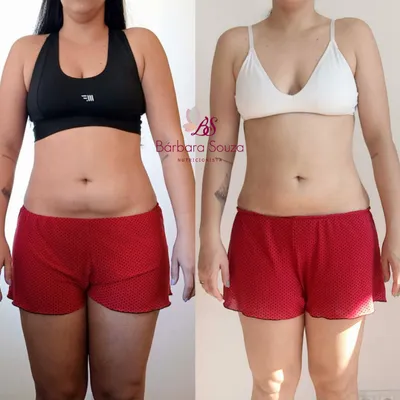 Antes e depois 1