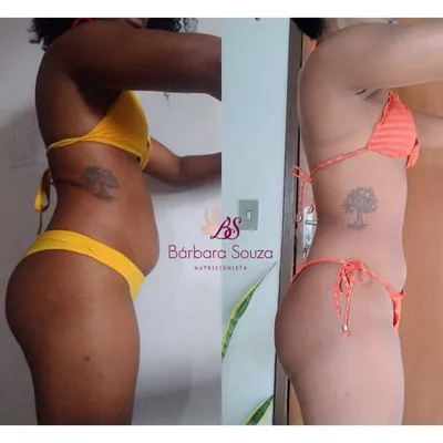 Antes e depois 2