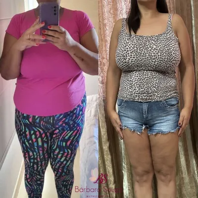 Antes e depois 3