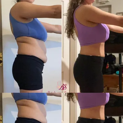 Antes e depois 4