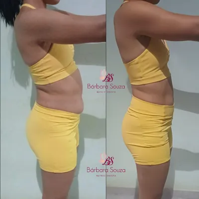 Antes e depois 5