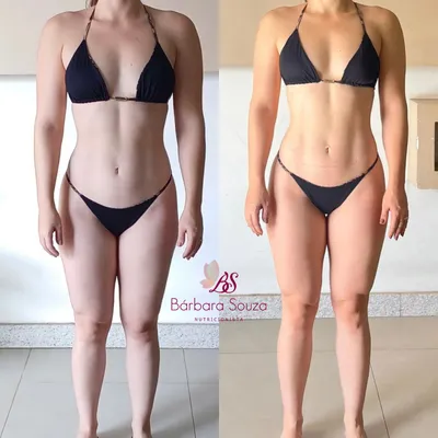Antes e depois 6